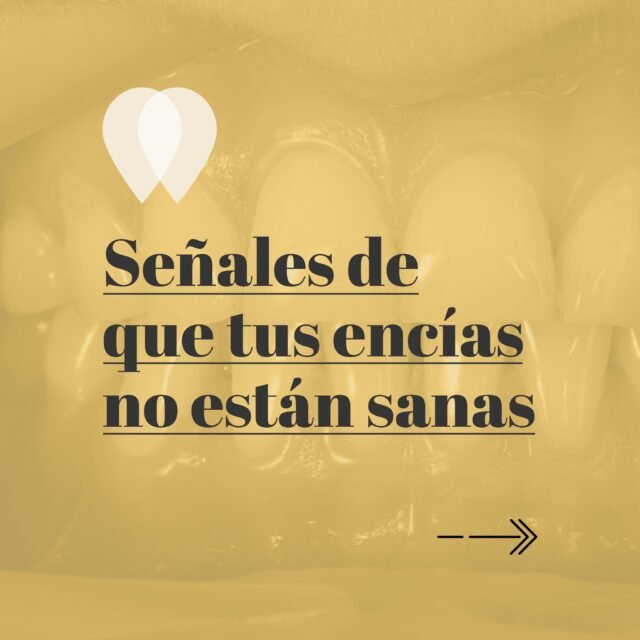 ¿Sabías que tus encías pueden avisarte cuando algo no va bien? Detectar los signos a tiempo es importante para prevenir la evolución de problemas como la gingivitis o la periodontitis y mantener una buena salud bucodental.
No esperes a que aparezca dolor para cuidar tus encías. Una revisión dental puede ayudarte a detectar cualquier problema y actuar a tiempo.
#SaludBucodental #Encías #Odontología #DentistaAlcala #MelguizoDental