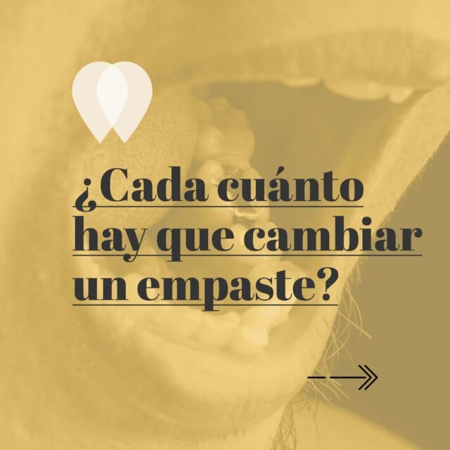 ¿Tienes un empaste desde hace años y te preguntas si ha llegado el momento de cambiarlo? La realidad es que no existe un plazo concreto para sustituir un empaste. 

Sin embargo, con el tiempo puede desgastarse, fracturarse o aparecer una nueva caries alrededor. Por eso, las revisiones periódicas permiten comprobar su estado y detectar cualquier problema antes de que avance.

Una revisión dental puede ayudarte a saber si siguen en buenas condiciones.

#SaludBucodental #Empastes #Odontología #DentistaAlcala #MelguizoDental