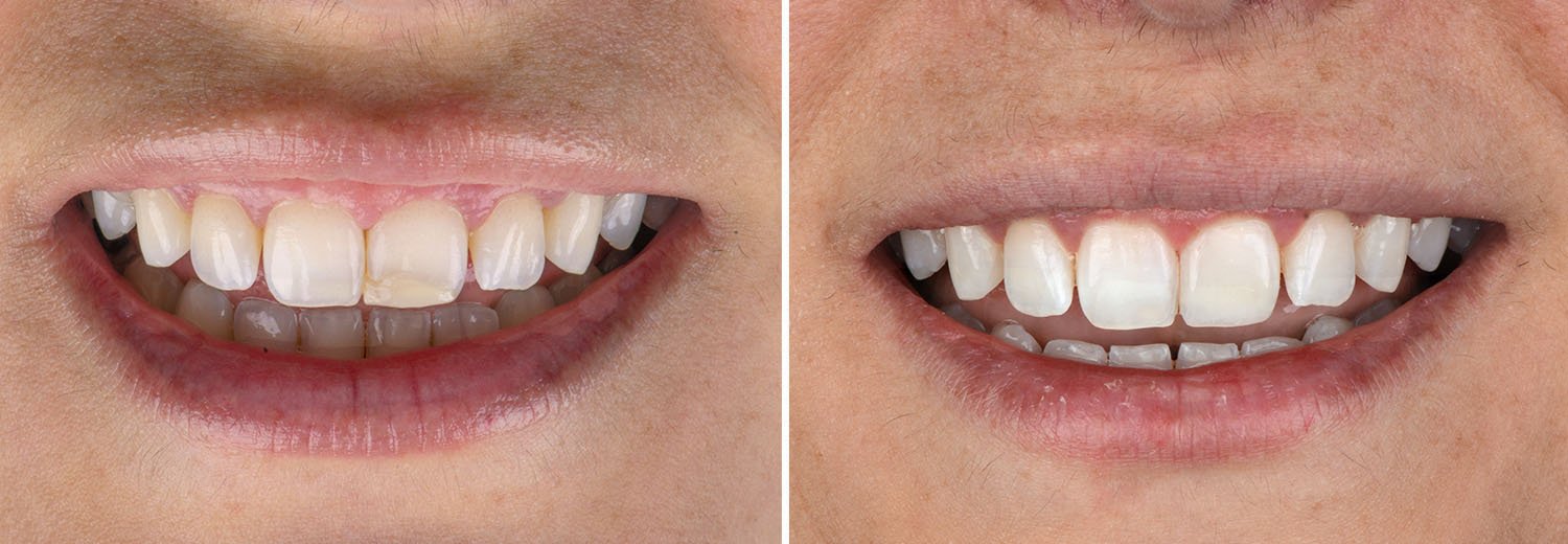 reconstrucción estética